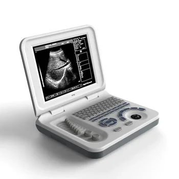 медицински пълен цифров Ultrasonido medico Цена & B &W преносим ултразвуков скенер машина с изпъкнала сонда