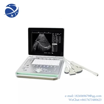 медицински UItrasound инструменти лаптоп ултразвукова машина B / W преносим ултразвуков скенер