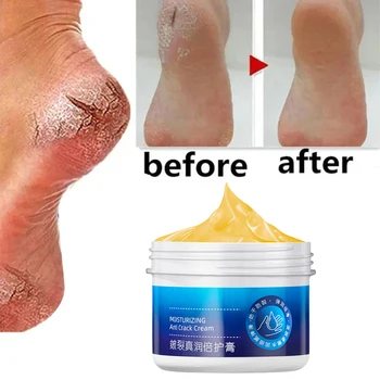 Анти-сушене Crack Hand Foot Care Cream Heel Cracked Repair Products Removal Мъртва кожа Хидратиращ Избелване Подхранване Грижа за кожата