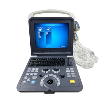 SY-A042-1 Висококачествен лаптоп цветен доплеров медицински ултразвуков инструмент с добра цена