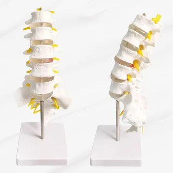 Модел на лумбалния гръбначен стълб Life Size Модел на анатомията на човешките лумбални прешлени със сакрум и гръбначни нерви Медицински инструмент за обучение